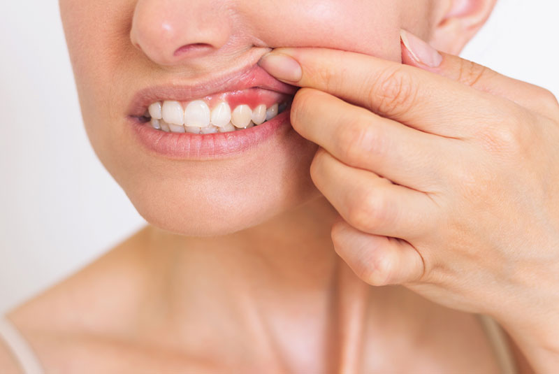 gum disease