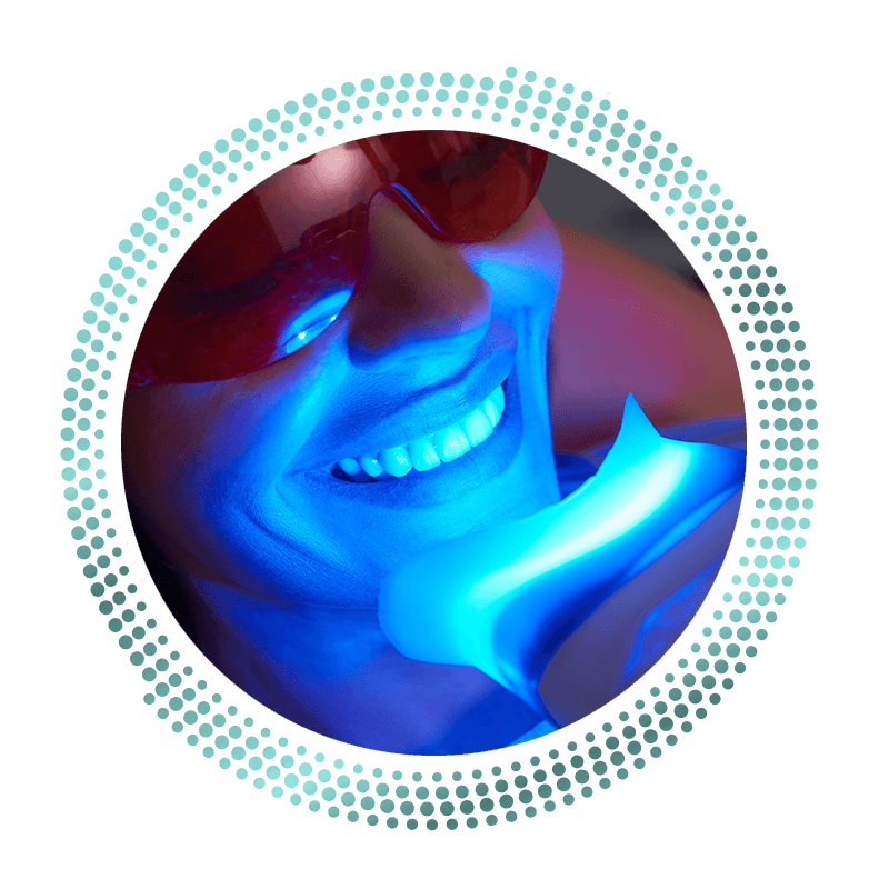 patient getting their teeth whitened