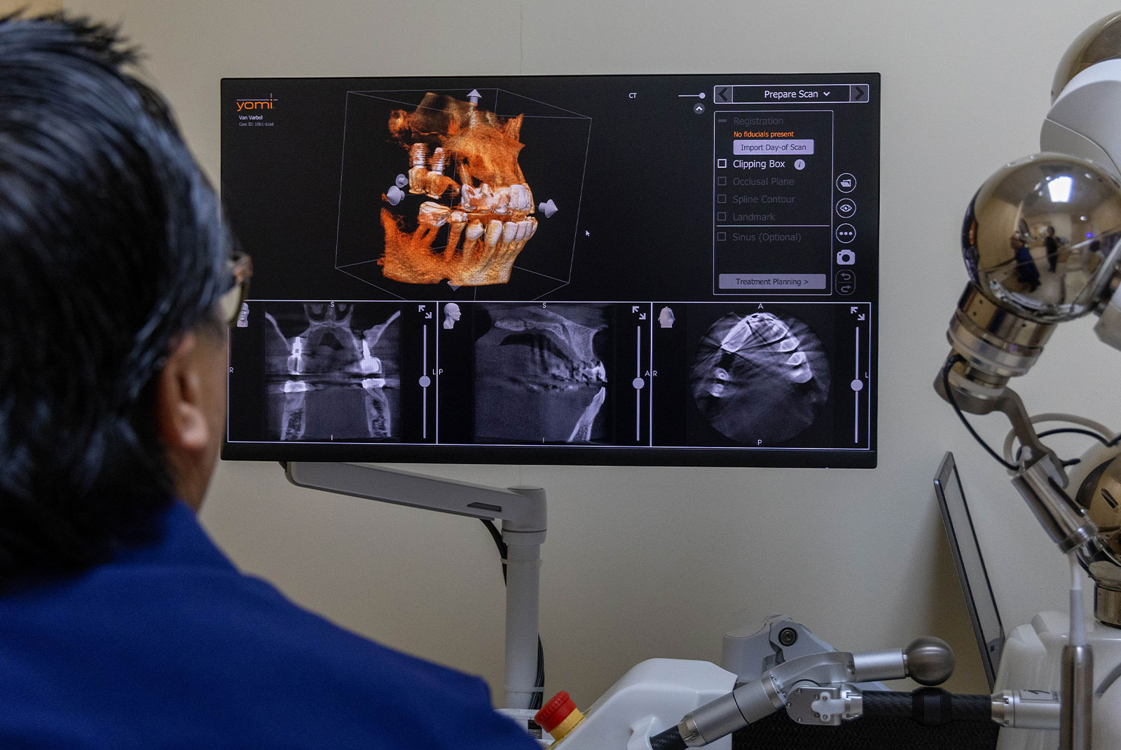 dr truong with yomi robot digital scan