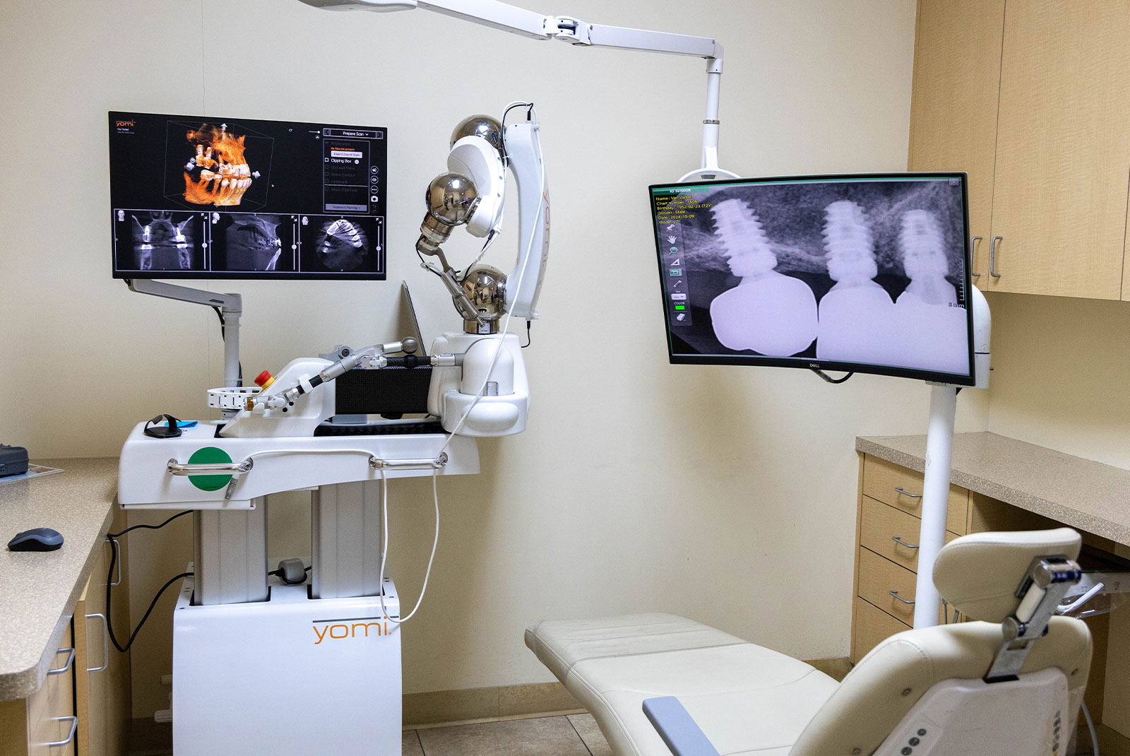 yomi robot at new image dental
